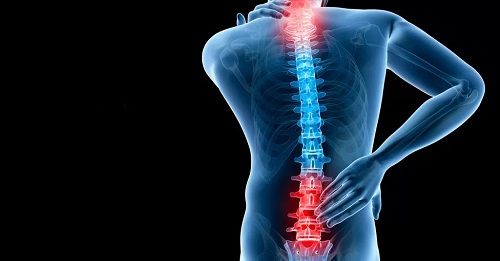 متخصص درمان بیرون زدگی دیسک شهریار