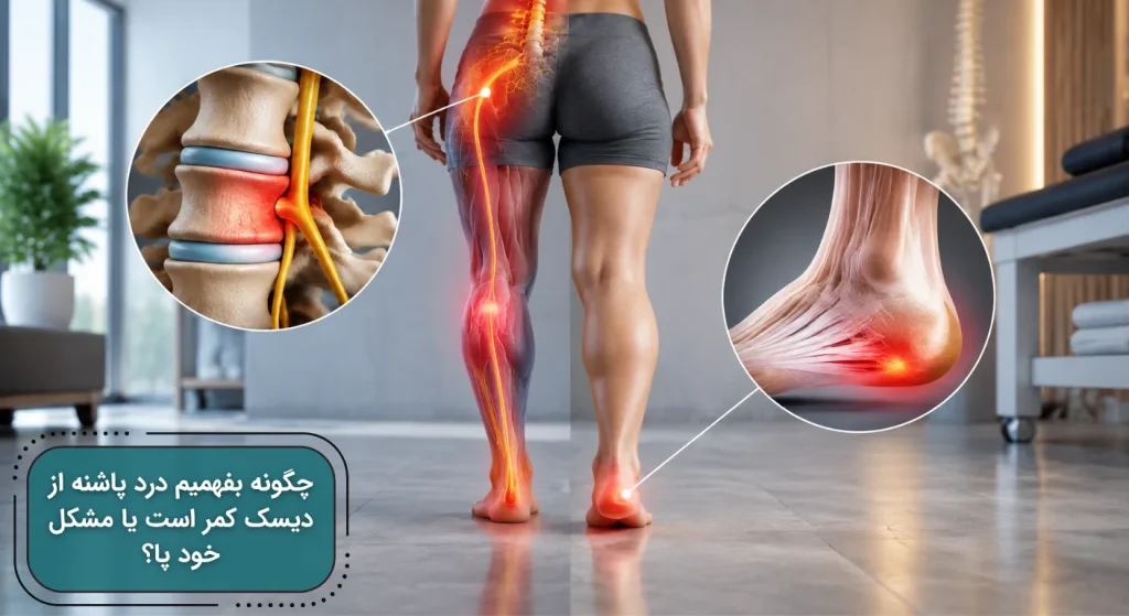 نمایش مسیر انتشار درد عصبی از دیسک کمر تا پاشنه پا